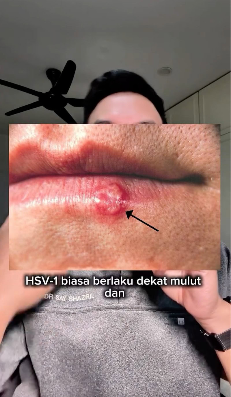 Dr Say